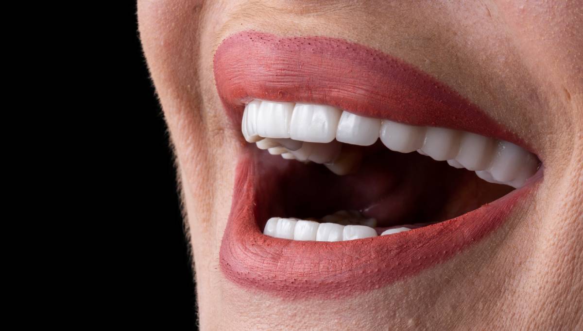 concept of woman after cleaning porcelain veneers