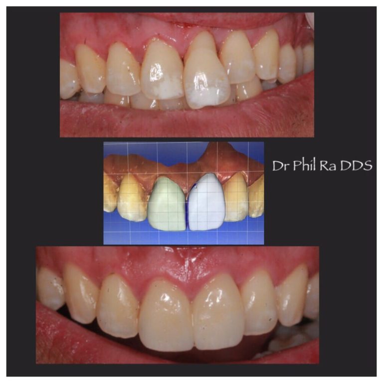 Patient 7 Before & After image