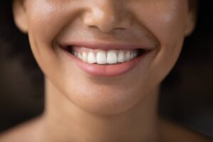 concept of what to eat after teeth whitening